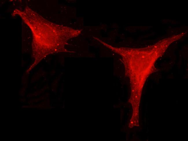 Leptin Antibody in Immunocytochemistry (ICC/IF)