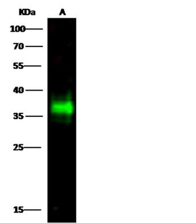 CD7 Antibody in Western Blot (WB)