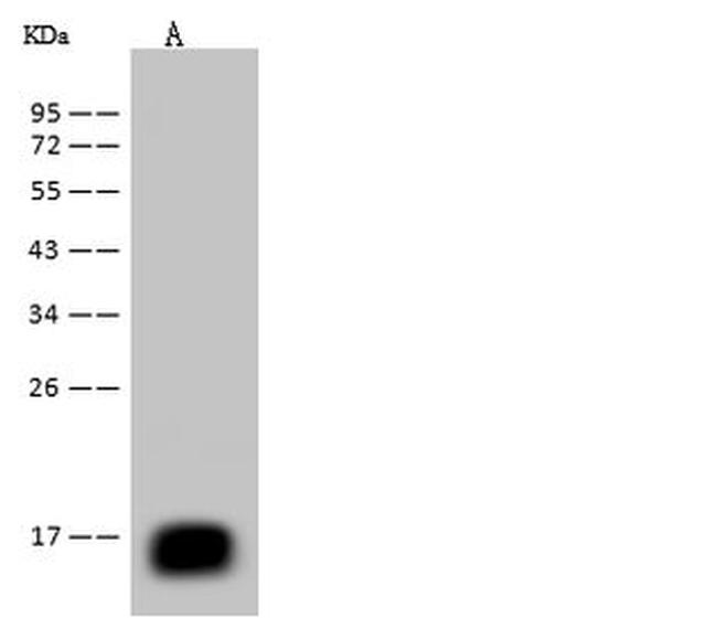 REG3B Antibody in Western Blot (WB)