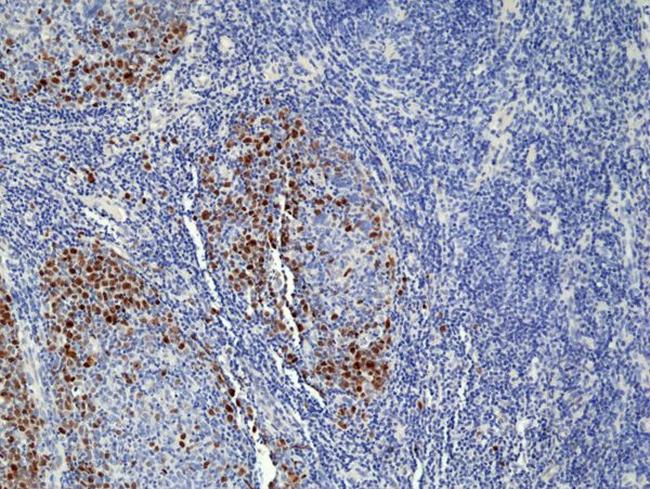 TOP2A Antibody in Immunohistochemistry (Paraffin) (IHC (P))