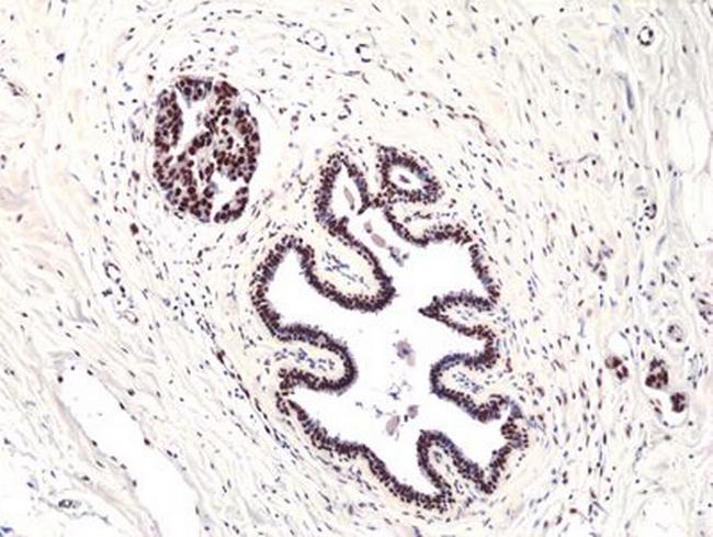 FOXP1 Antibody in Immunohistochemistry (Paraffin) (IHC (P))