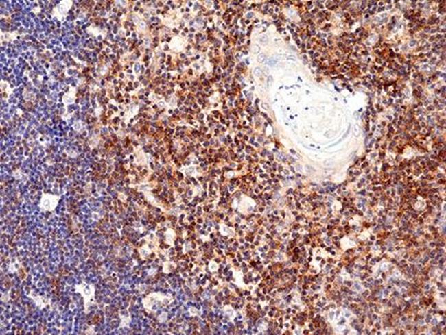 CD28 Antibody in Immunohistochemistry (Paraffin) (IHC (P))