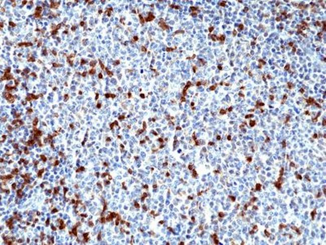 Zap-70 Antibody in Immunohistochemistry (Paraffin) (IHC (P))