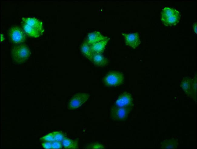 c-Fos Antibody in Immunocytochemistry (ICC/IF)