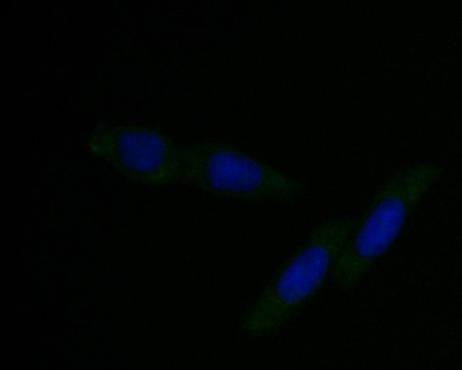 DFNA5 Antibody in Immunocytochemistry (ICC/IF)