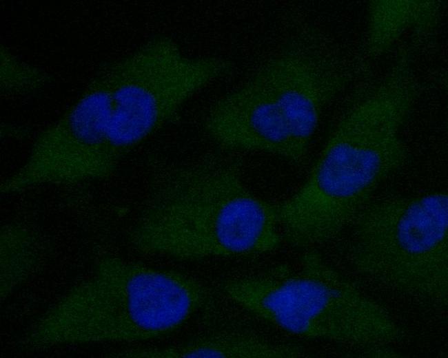 alpha Actinin Antibody in Immunocytochemistry (ICC/IF)