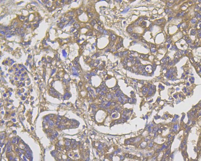 ROBO1 Antibody in Immunohistochemistry (Paraffin) (IHC (P))