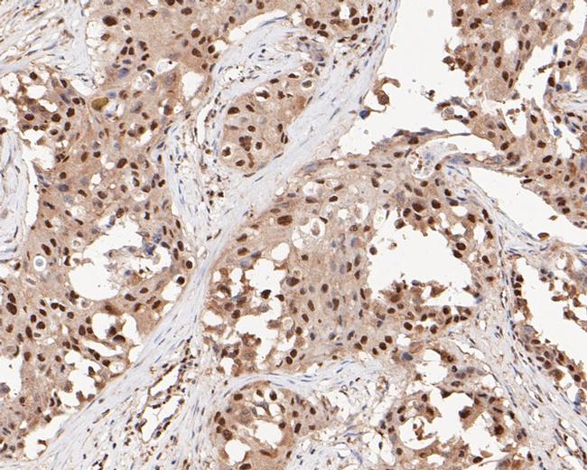 MTA2 Antibody in Immunohistochemistry (Paraffin) (IHC (P))