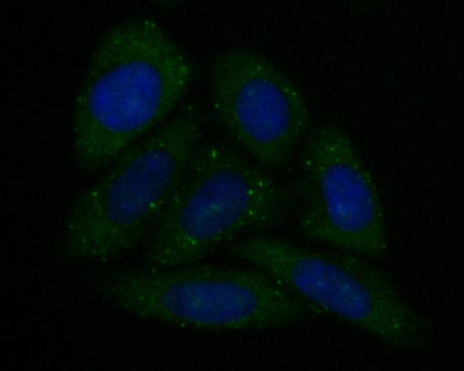 CAPZA1 Antibody in Immunocytochemistry (ICC/IF)