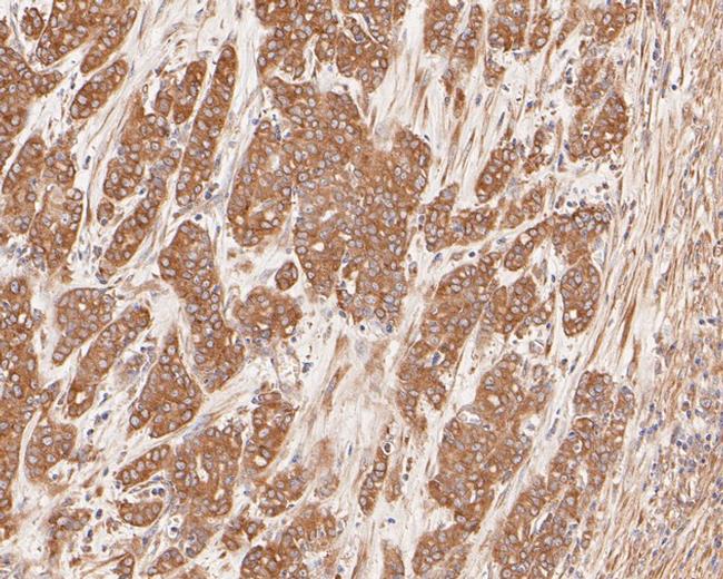 Cytokeratin 20 Antibody in Immunohistochemistry (Paraffin) (IHC (P))