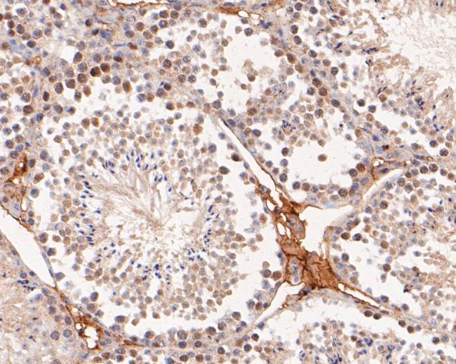 RAP80 Antibody in Immunohistochemistry (Paraffin) (IHC (P))