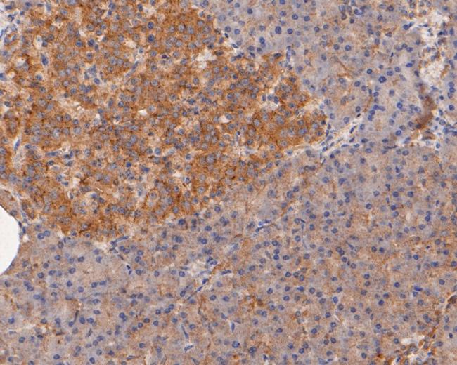 CASK Antibody in Immunohistochemistry (Paraffin) (IHC (P))