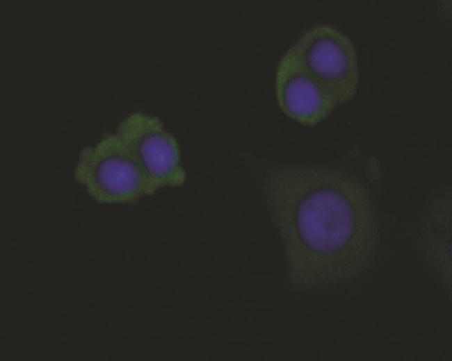 DAPK1 Antibody in Immunocytochemistry (ICC/IF)