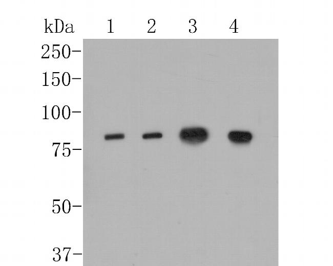 ApoER2 Antibody in Western Blot (WB)