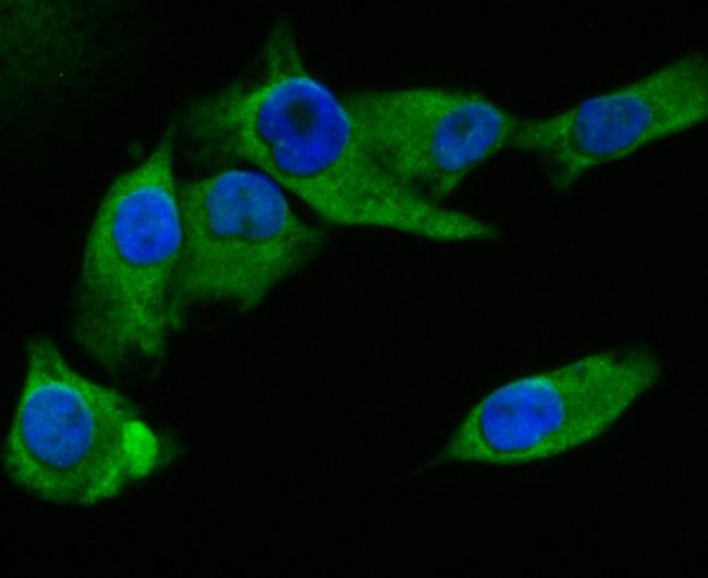 FBP1 Antibody in Immunocytochemistry (ICC/IF)