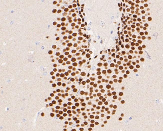 NeuroD2 Antibody in Immunohistochemistry (Paraffin) (IHC (P))