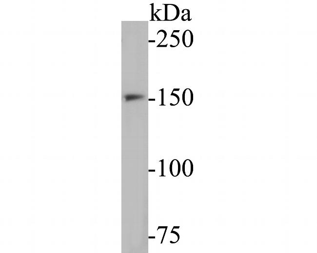 WRN Antibody in Western Blot (WB)