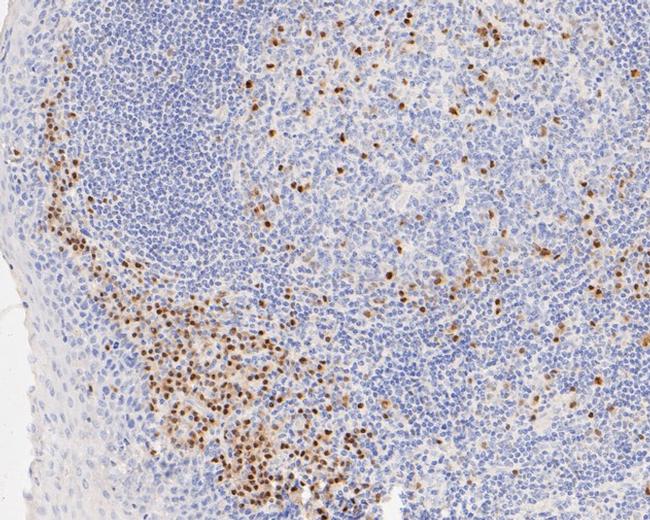 MUM1 Antibody in Immunohistochemistry (Paraffin) (IHC (P))