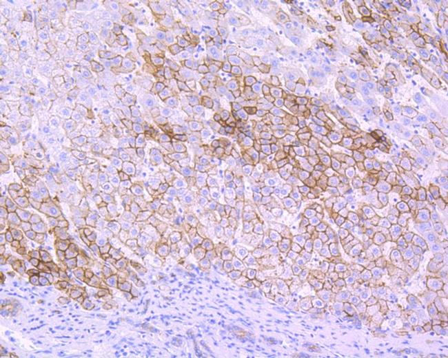 Villin Antibody in Immunohistochemistry (Paraffin) (IHC (P))