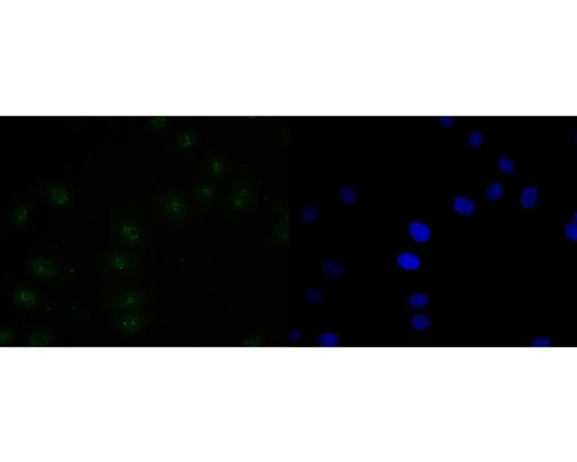 PAX2 Antibody in Immunocytochemistry (ICC/IF)