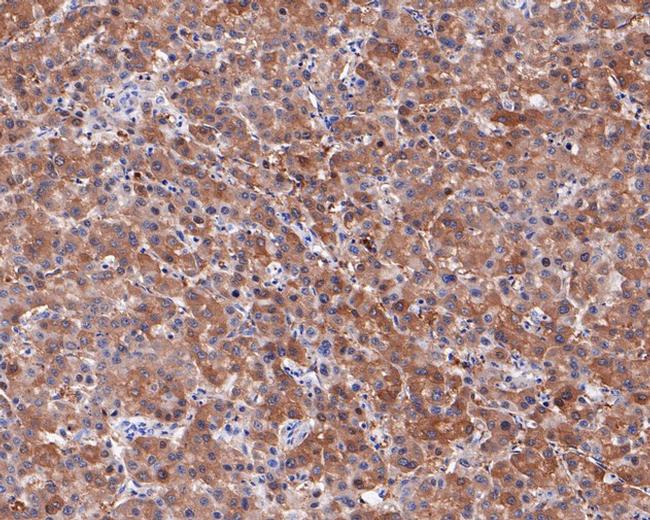 Neurocan Antibody in Immunohistochemistry (Paraffin) (IHC (P))