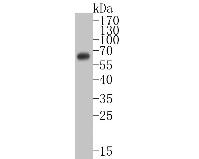 Estrogen Receptor alpha Antibody in Western Blot (WB)