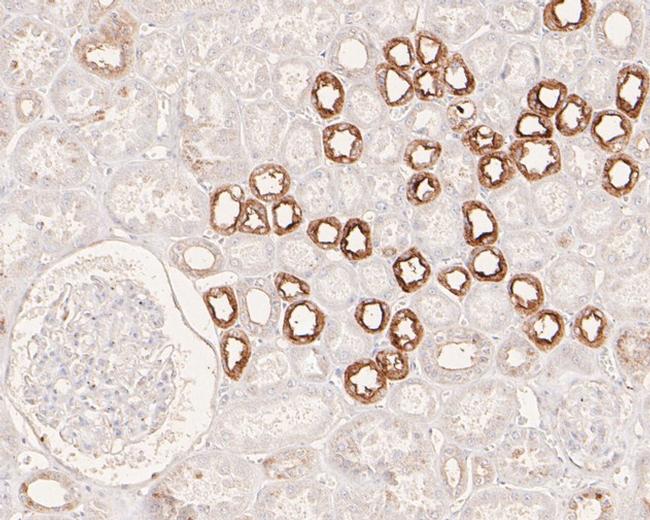 APLP2 Antibody in Immunohistochemistry (Paraffin) (IHC (P))