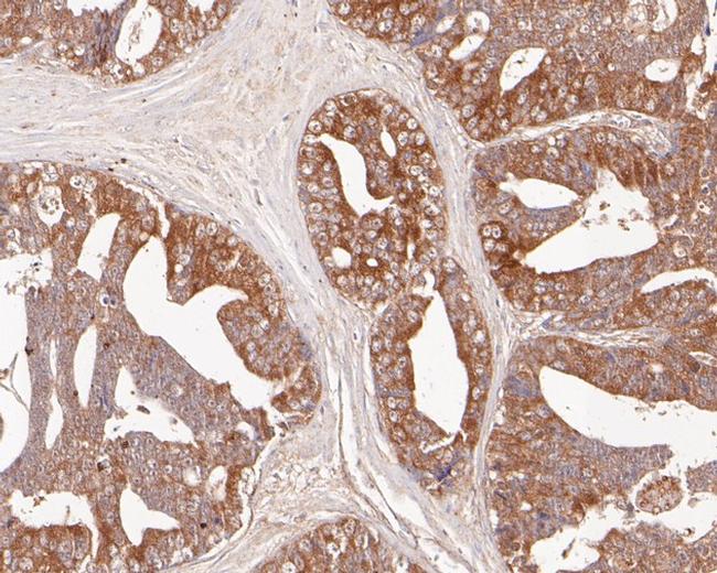 EphB3 Antibody in Immunohistochemistry (Paraffin) (IHC (P))