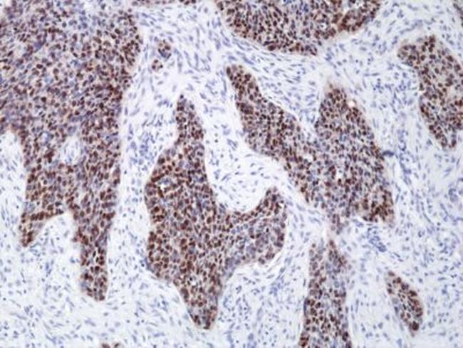 SOX2 Antibody in Immunohistochemistry (Paraffin) (IHC (P))