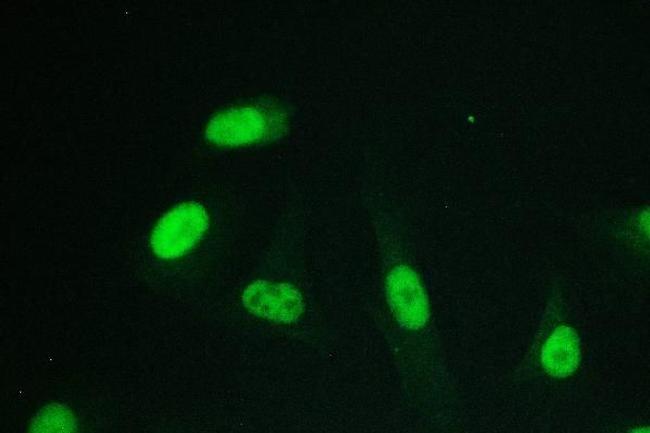 RPA70 Antibody in Immunocytochemistry (ICC/IF)