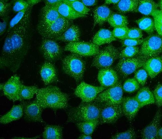 COPE Antibody in Immunocytochemistry (ICC/IF)