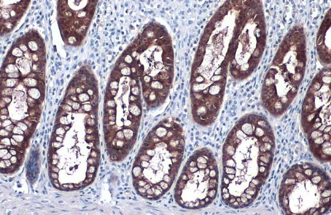 GPX2 Antibody in Immunohistochemistry (Paraffin) (IHC (P))