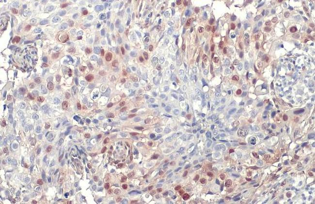 Phospho-ERK1/ERK2 (Thr202, Tyr204, Thr185, Tyr187) Antibody in Immunohistochemistry (Paraffin) (IHC (P))