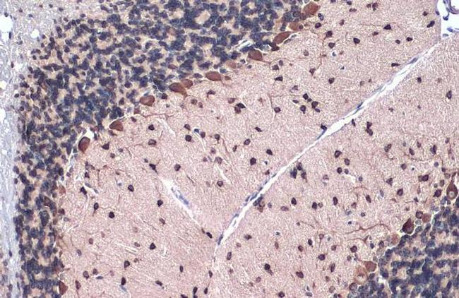 Gli1 Antibody in Immunohistochemistry (Paraffin) (IHC (P))