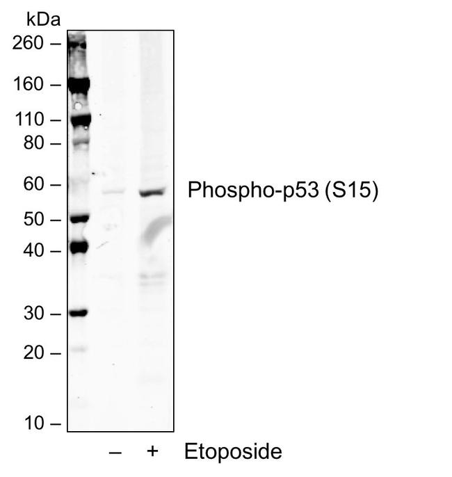 Phospho-p53 (Ser15) Antibody in Western Blot (WB)