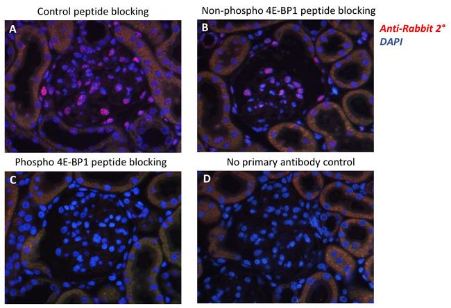 Phospho-4EBP1 (Thr37, Thr46) Antibody in Immunohistochemistry (IHC)