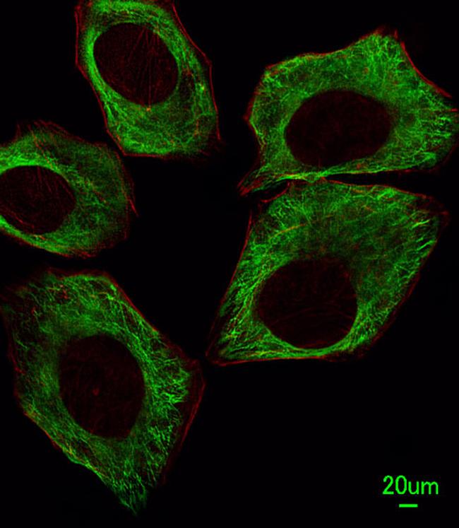 beta Tubulin Antibody in Immunocytochemistry (ICC/IF)