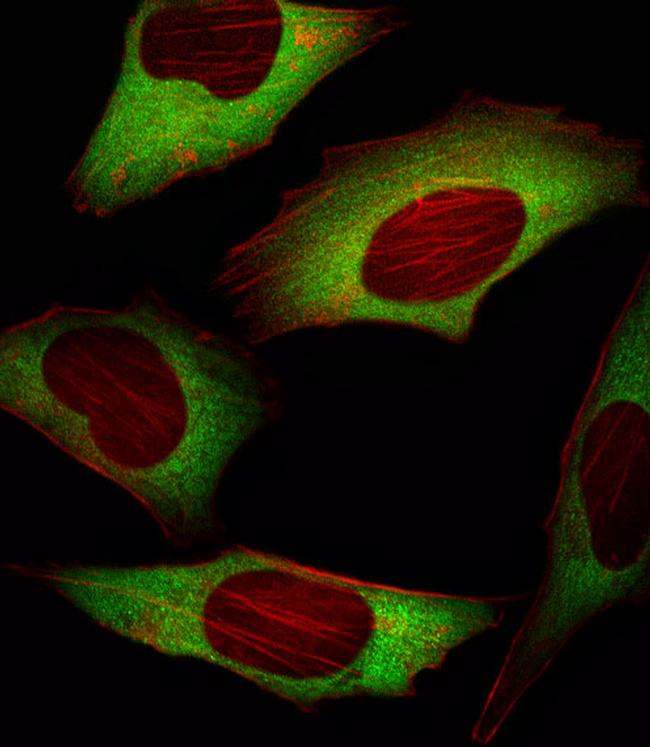 eIF4E Antibody in Immunocytochemistry (ICC/IF)