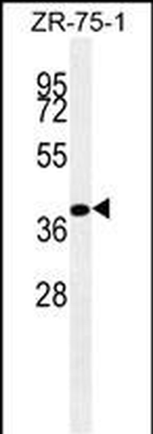 BMP-4 Antibody in Western Blot (WB)