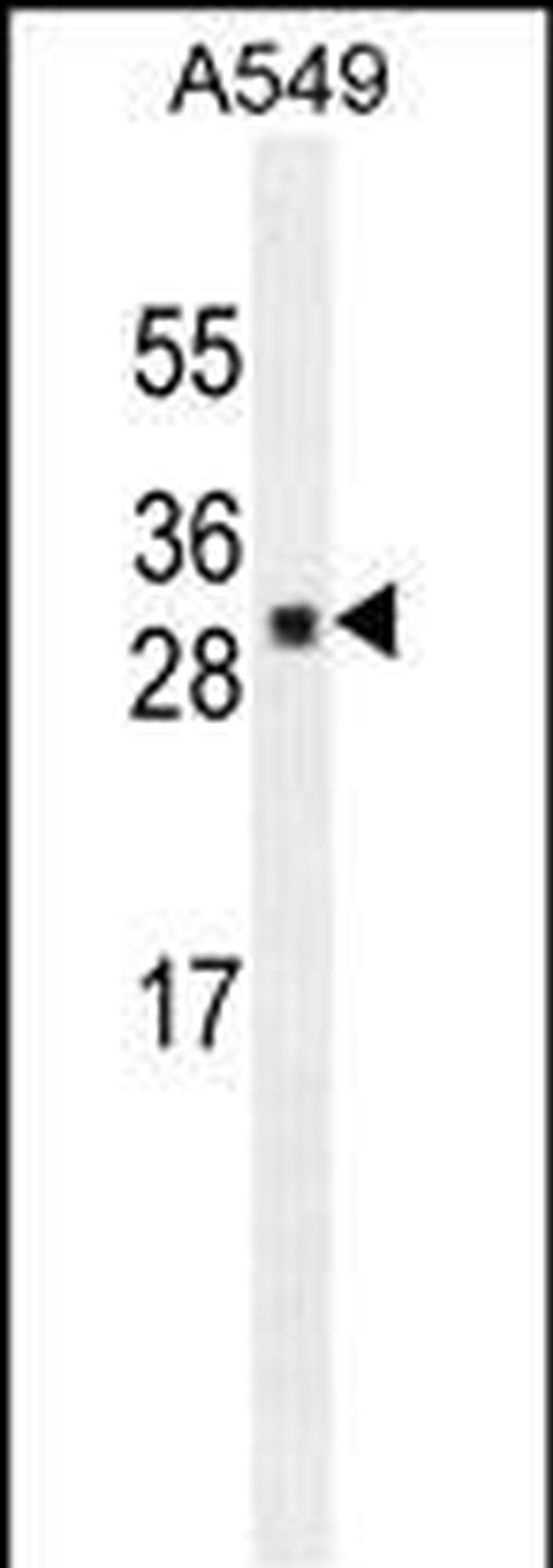 UBTD1 Antibody in Western Blot (WB)