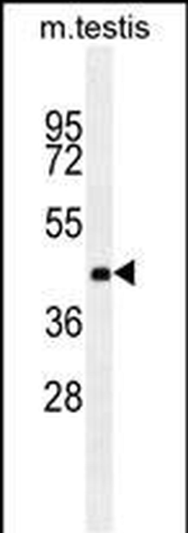 ZNF622 Antibody in Western Blot (WB)