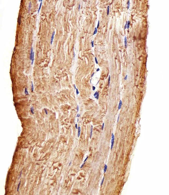 MAP4K3 Antibody in Immunohistochemistry (Paraffin) (IHC (P))