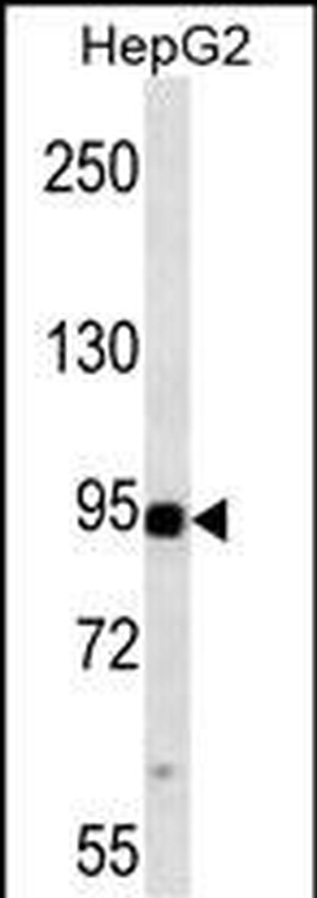 MLK3 Antibody in Western Blot (WB)