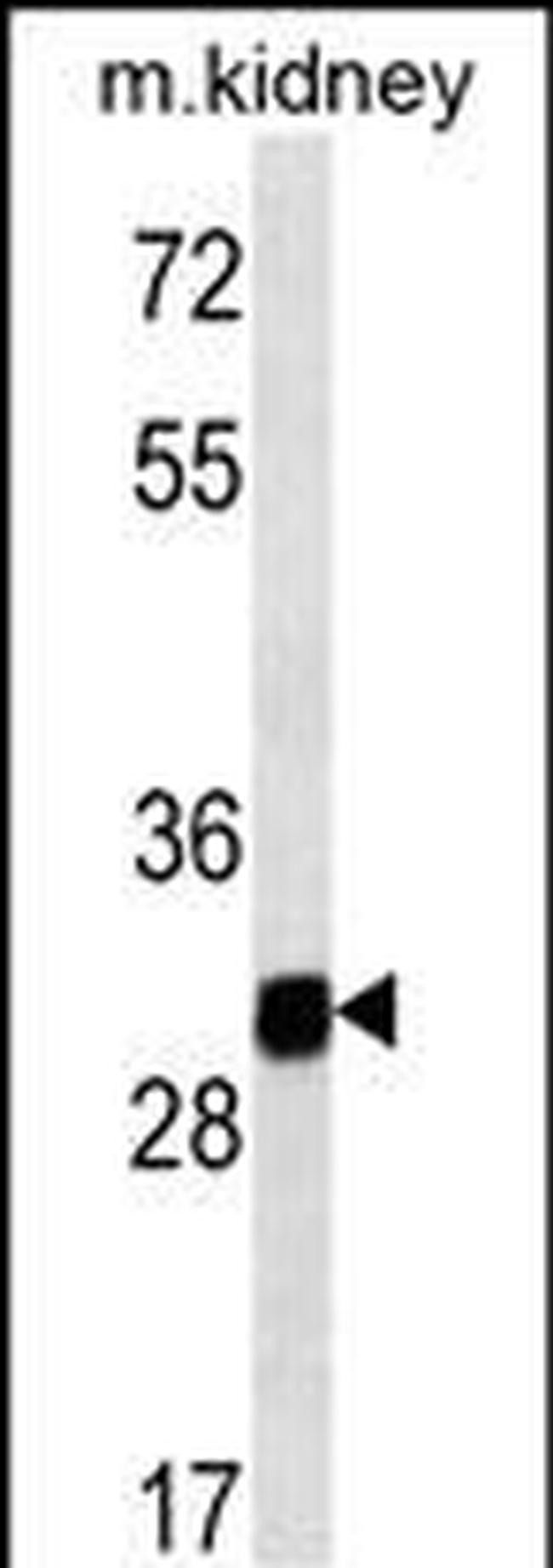 GNPDA1 Antibody in Western Blot (WB)