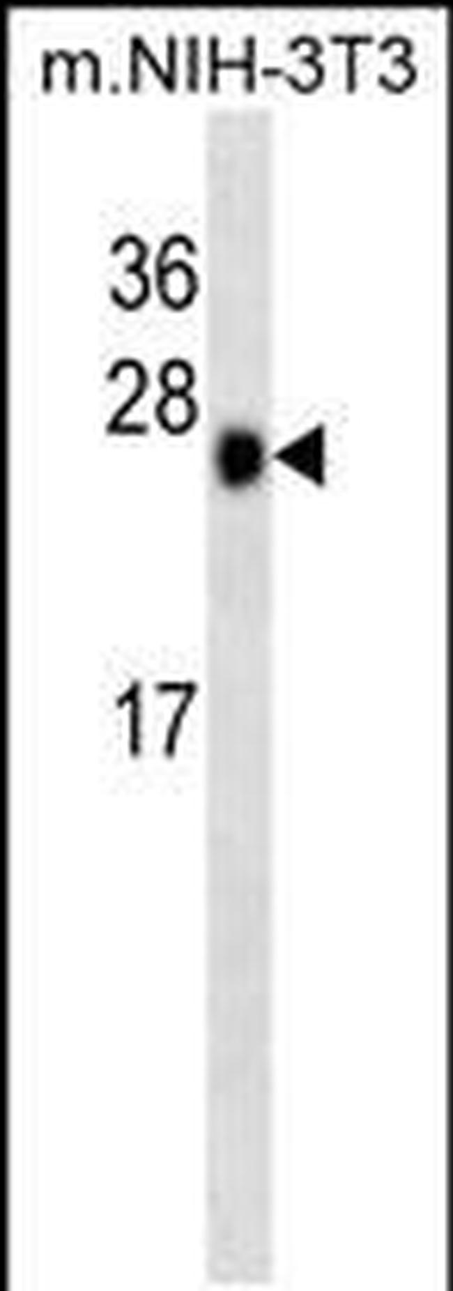 CK2 beta Antibody in Western Blot (WB)