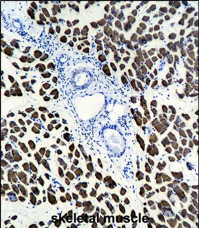 ACTA1 Antibody in Immunohistochemistry (Paraffin) (IHC (P))