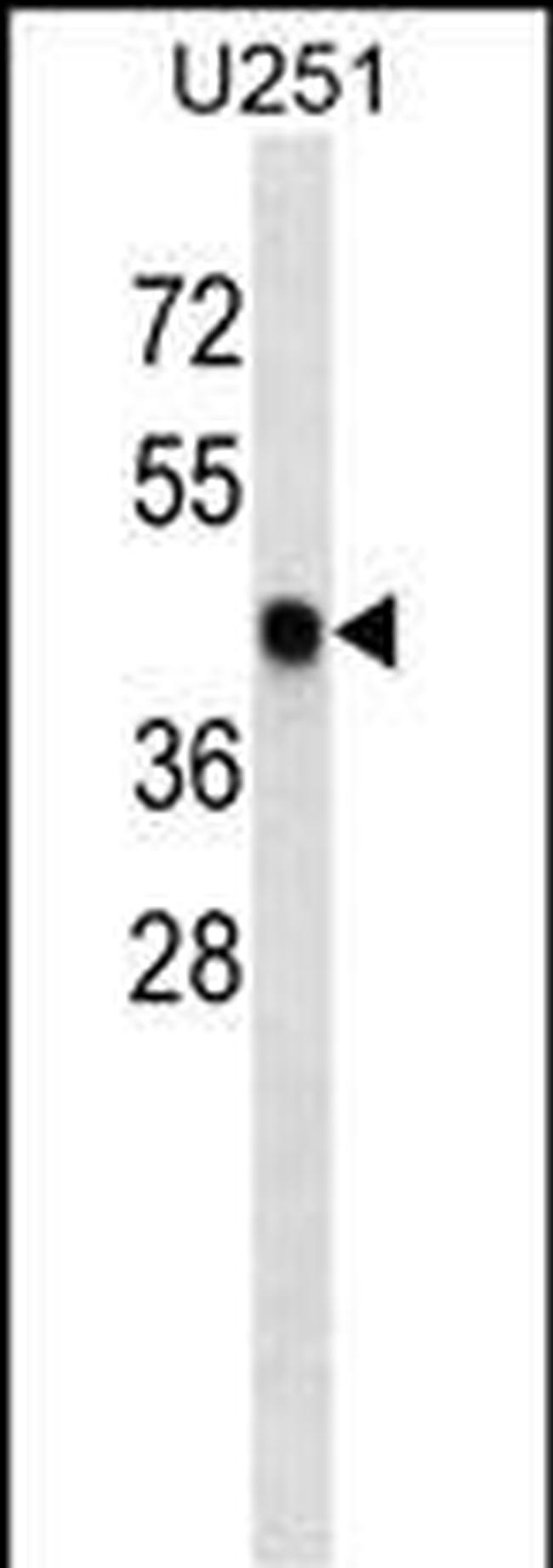 SNX6 Antibody in Western Blot (WB)