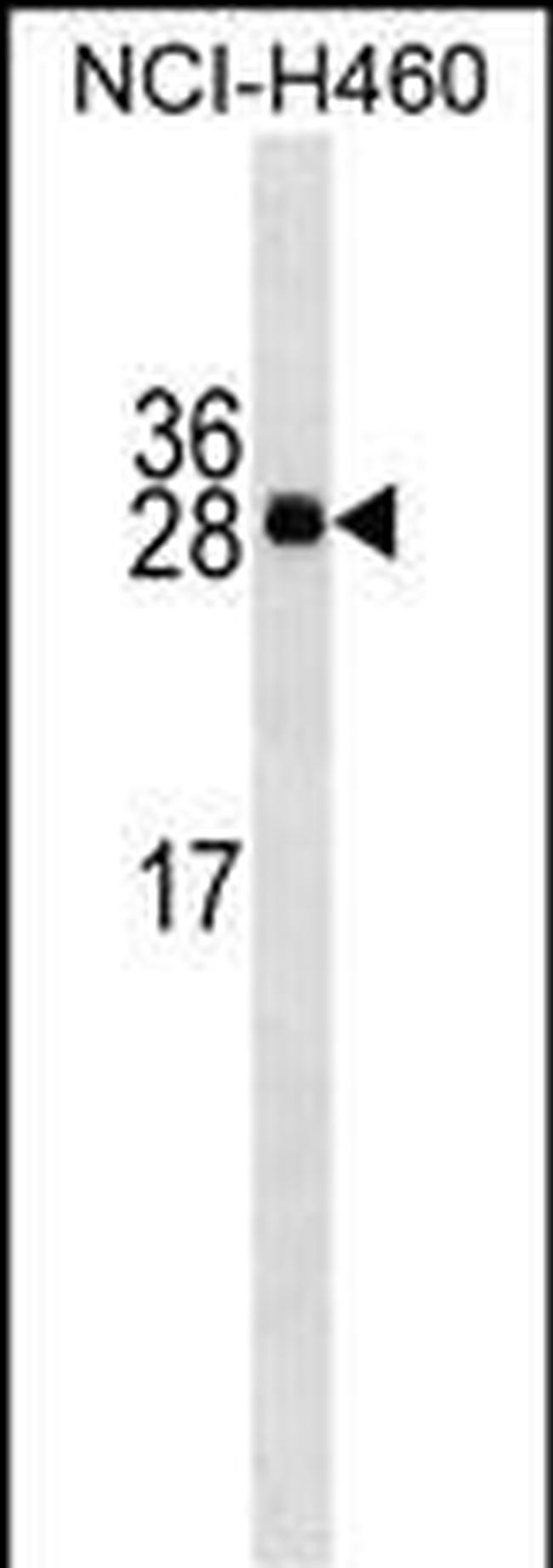 Serum Amyloid P Antibody in Western Blot (WB)