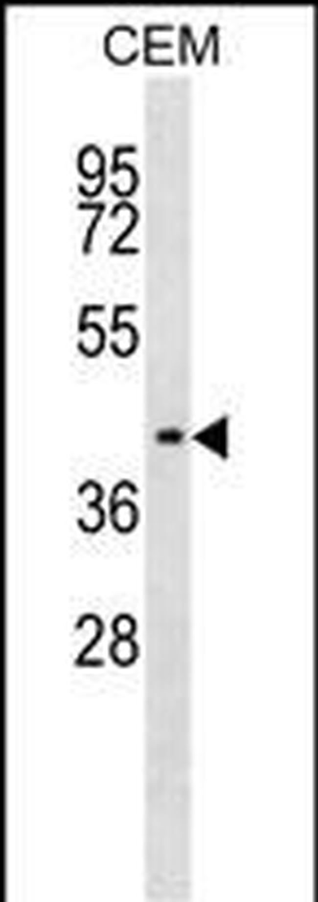 IHH Antibody in Western Blot (WB)