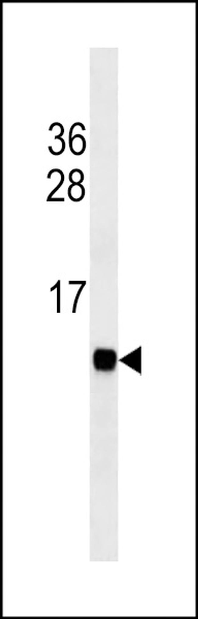 FABP3 Antibody in Western Blot (WB)